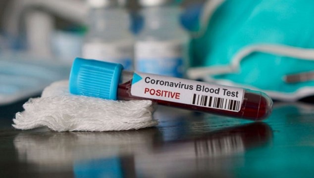 Οι διαφορές μεταξύ Covid-19 και της γρίπης