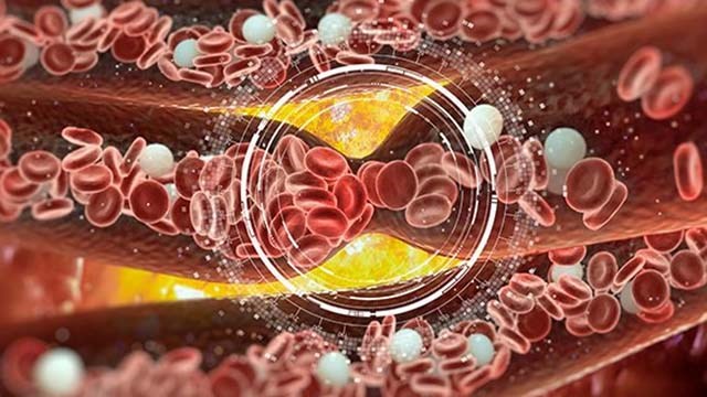 Ζώντας το έμφραγμα μυοκαρδίου σε νησί. Η ανάγκη για θρομβόλυση τώρα !